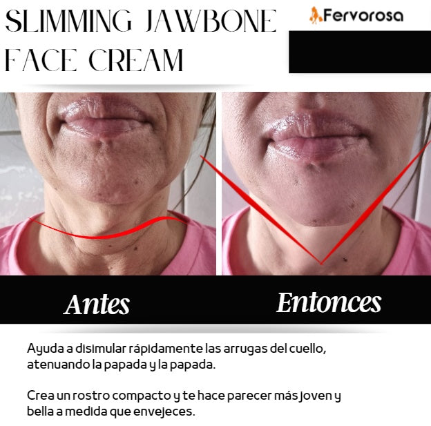 REDUCTOR DE PAPADA - LIFTING PRO