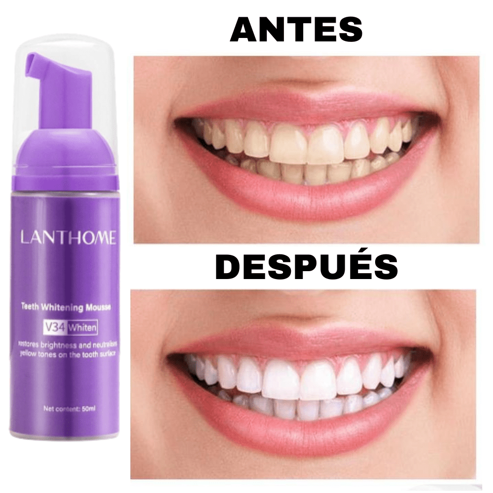 Blanqueamiento Dental LantHome Fresh White